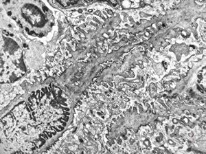 jejunal mucosa - contracted smooth muscle cells jejunal mucosa - contracted smooth muscle cells